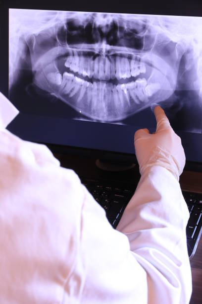 Best Dentist for Tooth Abscess  in Kechi, KS