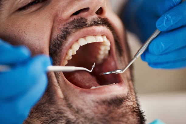 Best Teeth Whitening  in Kechi, KS